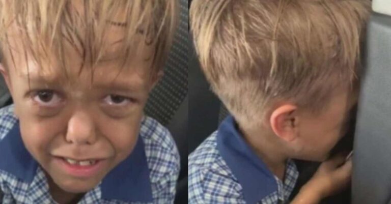 Θυμάστε τον 9χρονο με νανισμό που είχε δεχθεί άγριο bullying; Δείτε πώς είναι και τι κάνει σήμερα το αγοράκι που είχε συγκινήσει τον πλανήτη