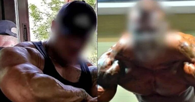 «Προστασία» γνωστού τράπερ ο αστυνομικός που συνελήφθη γιατί διακινούσε ναρκωτικά με υπηρεσιακό ΙΧ