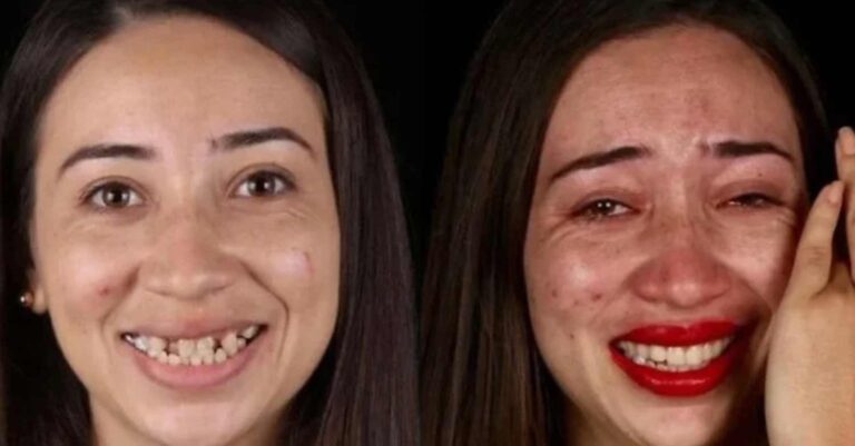 Οδοντίατρος φτιάχνει δωρεάν τα δόντια φτωχών ανθρώπων και μοιράζει χαμόγελα ευτυχίας