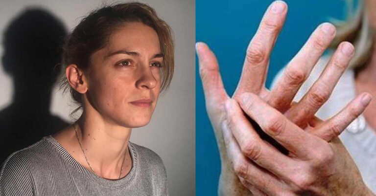 Γιούλικα Σκαφιδά: «Το δικό μου δακτυλικό αποτύπωμα ονομάζεται και Σκλήρυνση κατά Πλάκας»