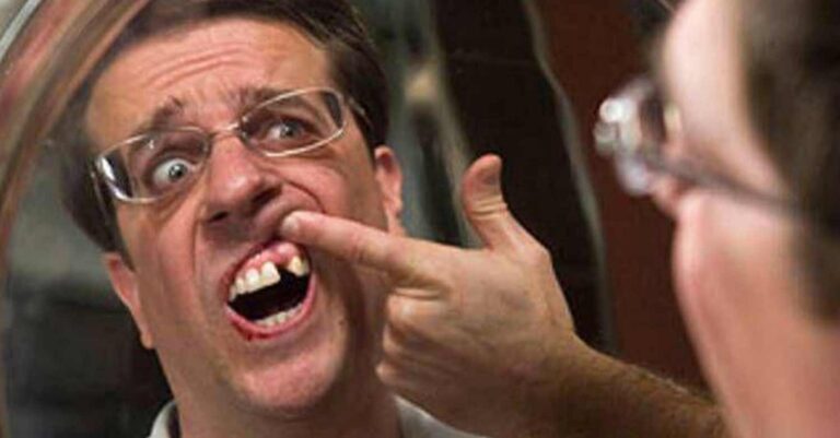 Μου λείπει ένα δόντι και φοβάμαι να βγω με κάποιον μην ξεφτιλιστώ