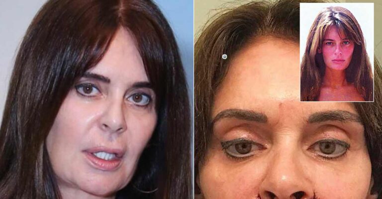 Πλαστικός της έλιωσε το πρόσωπο: H Κατερίνα Πλουμιδάκη πήγε να βάλει τέλος στη ζωή της δυο φορές