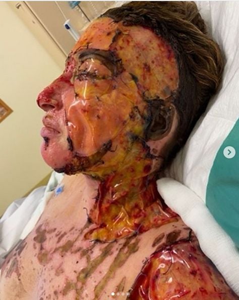 nb keimeno paliospyrou vitrioli