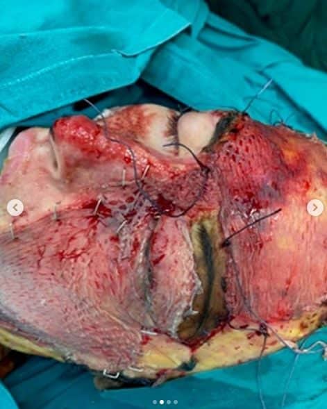 nb keimeno paliospyrou vitrioli1