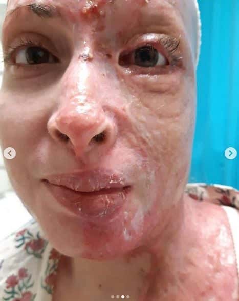 nb keimeno paliospyrou vitrioli2