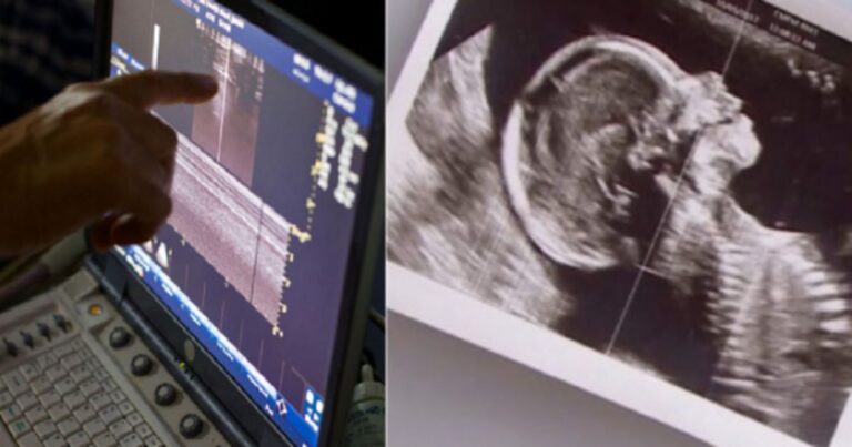 Συγκλονιστικό: Ζευγάρι με δίδυμα περιμένει και πάλι παιδί, αλλά ο γιατρός δείχνει το υπερηχογράφημα και ο σύζυγος αμέσως λιποθυμά