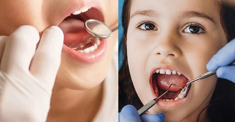 Dentist Pass για παιδιά: Άνοιξαν οι αιτήσεις για δωρεάν επίσκεψη σε οδοντίατρο