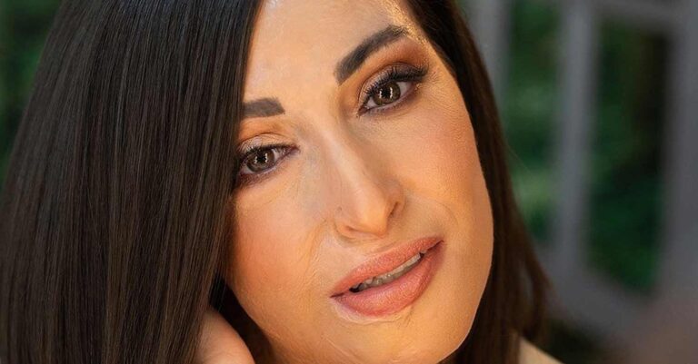 Για πρώτη φορά: Φωτογραφίες της Ιωάννας Παλιοσπύρου μετά την επίθεση με το βιτριόλι