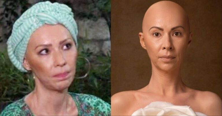 «Χώρıσε τnν άρρωστn», εiπαν στον σύντροφό μου. Ήμουν φαλακρή κι αuτός μου έλεγε «είσαι η πιο όμορφη γυναίκα»