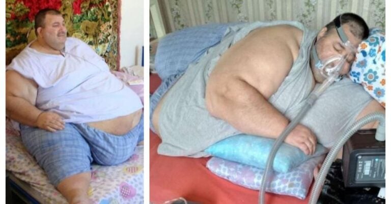 Κομοτηνή: Ασθενής που ζυγίζει 360 κιλά καταγγέλλει ότι το ΕΚΑΒ αρνείται να τον μεταφέρει στο νοσοκομείο