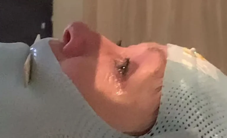 Συγκλονίζει η Σάνεν Ντόχερτι για τον καρκίνο: «Ο φόβος μου είναι προφανής» – Το βίντεο από τις ακτινοβολίες