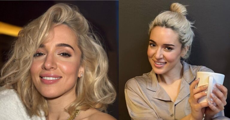 Η Καλομοίρα πριν την πλαστική: Το μοναδικό σημείο στο σώμα της που έχει κάνει επέμβαση