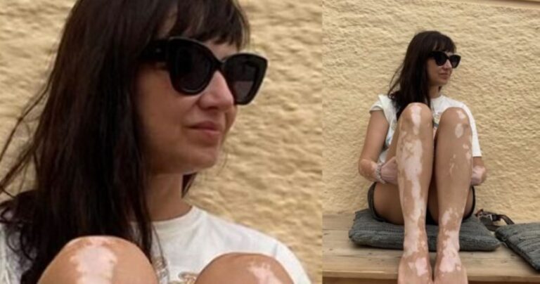 Μαθήματα αυτοεκτίμησης από την Αθηναΐς Νέγκα: «Πήρα τη λεύκη μου για ποτό στην Άνω Σύρο» – Η πιο δυνατή φωτογραφία του καλοκαιριού!