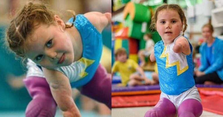 Μόλις 10 μηνών έχασε χέρια και πόδια από μηνιγγίτιδα και στα 7 της χρόνια πήρε χρυσό στην ενόργανη
