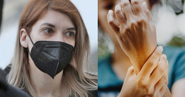 Λύκος: Το αυτοάνοσο νόσημα από το οποίο πάσχει η Ρούλα Πισπιρίγκου – Σε ποια μέρη του σώματος εμφανίζονται τα συμπτώματα