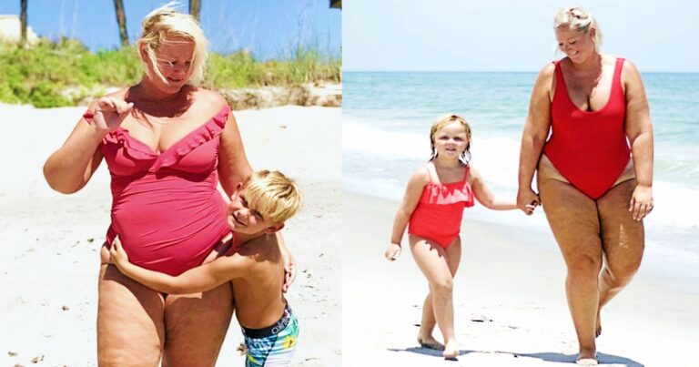 «Πηγαίνω στην παραλία με καμάρι για τα κιλά, τις ραγάδες & τη κυτταρίτιδά μου, είμαι περήφανη για το σώμα μου»