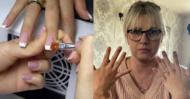 «Δεν μπορούσα να κουνήσω τα χέρια μου»: 36χρονη έπαθε ανεπανόρθωτη ζημιά από τζελ νυχιών & προειδοποιεί άλλες γυναίκες