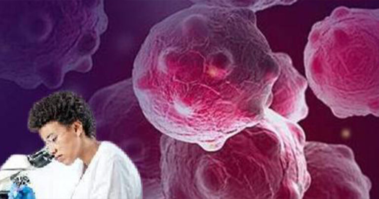 Ανεκάλυψαν μονοκλωνικό αντίσωμα που σκοτώνει καρκινικά κύτταρα ακόμα σε προχωρημένους καρκίνους