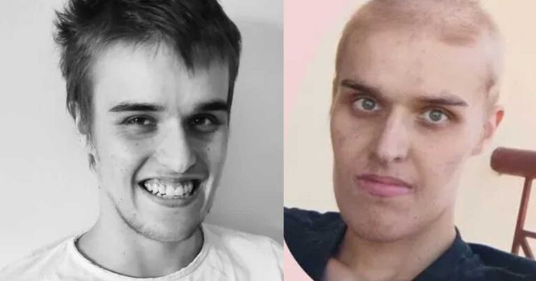 Ευχάριστα νέα: Τα κατάφερε ο 19χρονος Τζόναθαν – Πήρε εξιτήριο από το Νοσοκομείο