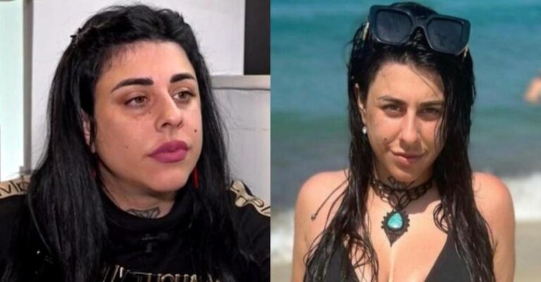 «Τα ράμματα είναι θανατηφόρα»: Η φωτο της Σούπερ Κικής με αναπηρικό καροτσάκι μετά το χειρουργείο για αφαίρεση λίπους