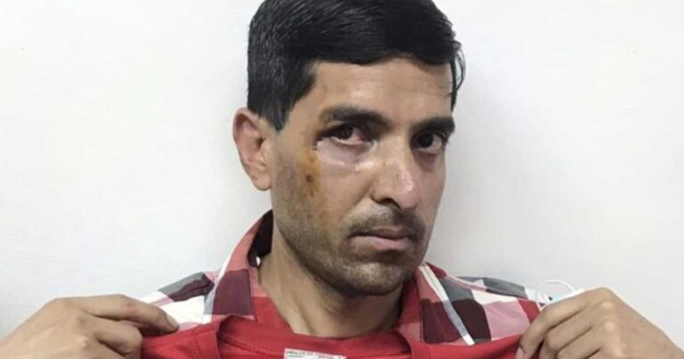 Καταγγελία για άγριο ξυλοδαρμό δύο μεταναστών σε Περιστέρι και Σεπόλια
