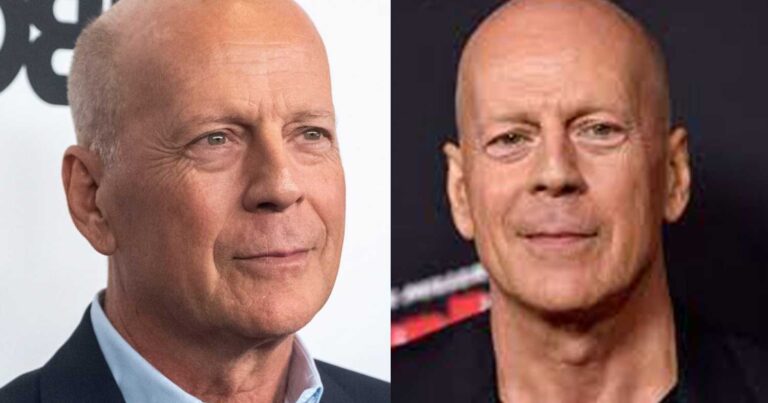 Άσχημα νέα για τον Μπρους Γουίλις – Χειροτέρεψε η υγεία του