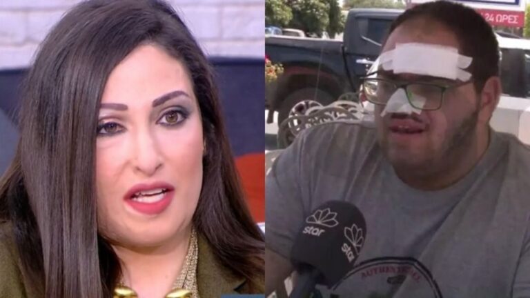 Υπάρχει ανθρωπιά: Η Ιωάννα Παλιοσπύρου αναλαμβάνει όλα τα έξοδα του 22χρονου που κάηκε από λάδι στην Κρήτη