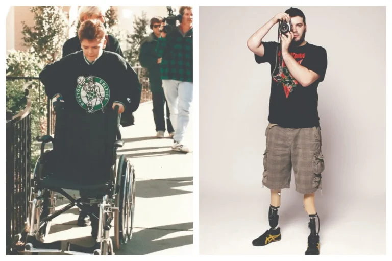 Το συγκλονιστικό μήνυμα του Βασίλη Δοσούλα 29 χρόνια μετά το τραγικό ατύχημα: «Γιορτάζω τη ζωή μου…»