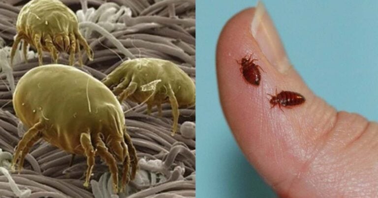 Ακάρεα, κοριοί, τσιμπούρια: Πως θα ξεχωρίσετε 9 διαφορετικά τσιμπήματα και τι πρέπει να κάνετε στο καθένα