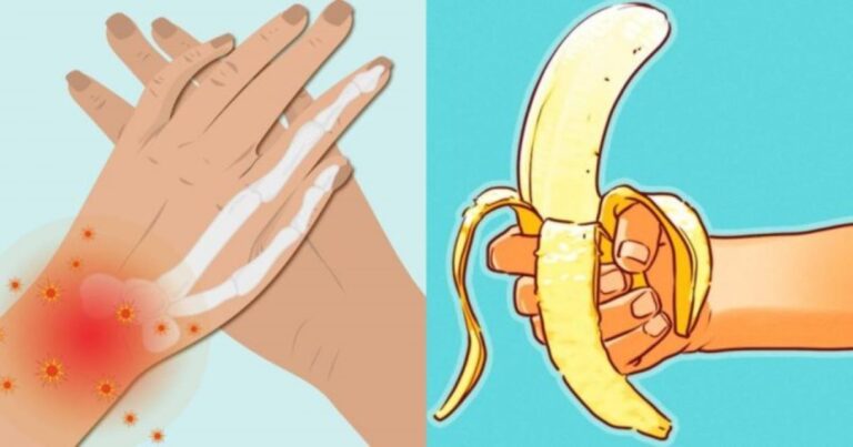 Χρόνια φλεγμονή: Τα ύπουλα σημάδια – 6 τροφές που την καταπολεμούν και 5 που την επιδεινώνουν