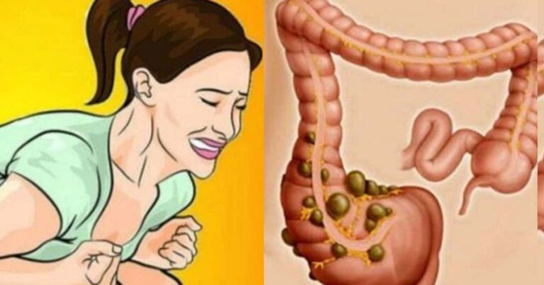 Δυσκοιλιότητα τέλος: 9 φυσικές θεραπείες που θα σας ανακουφίσουν αμέσως