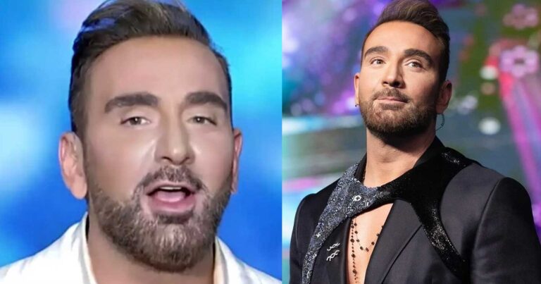 Έγινε… Σουηδός: Ο Νίκος Κοκλώνης έβαψε κατάξανθα μαλλιά και μούσια και οι γυναίκες λιποθuμούν