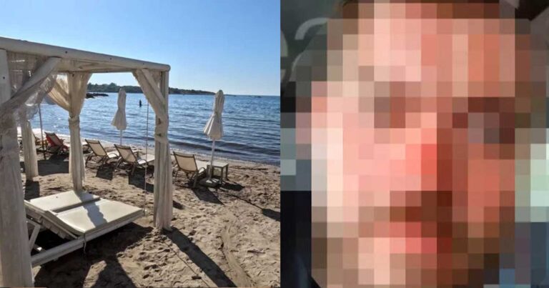 Ηράκλειο: Σεκιούριτι ξυλοκόπησε ξεναγό γιατί επιχείρησε να περάσει μπροστά από παραλία ξενοδοχείου – «Μου είπαν ότι λιποθύμησα»