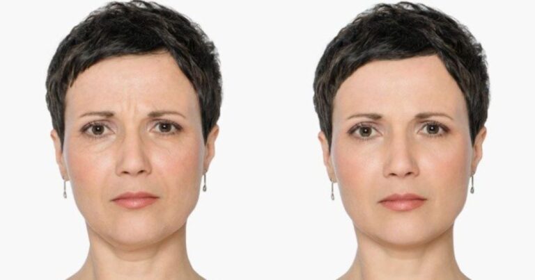 Κλιμακτήριος: 11 συμβουλές των ειδικών για να διατηρήσετε τη νεότητά σας κατά τη διάρκεια της εμμηνόπαυσης