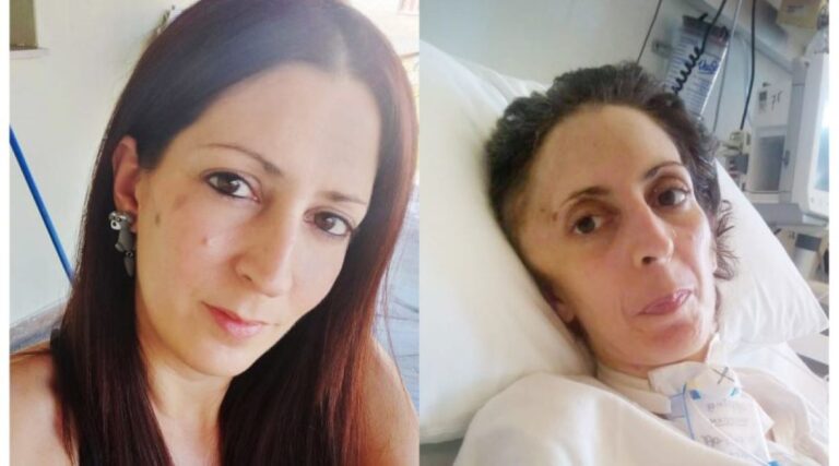 Πέθανε η Όλγα από την Αργυρούπολη που είχε ξυλοκοπηθεί άγρια από τον πρώην σύντροφό της