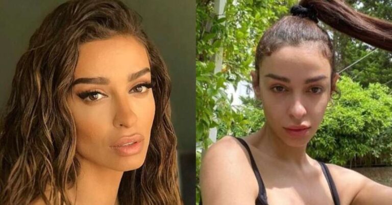 Πιο γυμνασμένη από ποτέ, 6 μήνες μετά τη γέννα: Η Ελένη Φουρέιρα «έριξε» το Ιnstagram με μια φωτογραφία