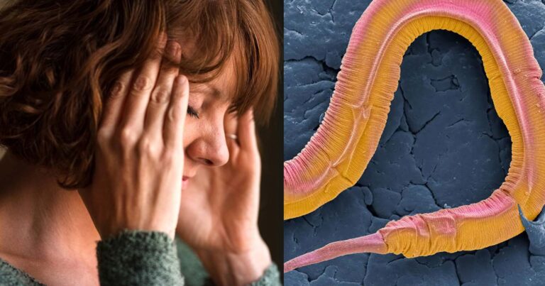 Γυναίκα πήγε στο νοσοκομείο επειδή ξεχνούσε εύκολα – Έπαθαν σoκ οι γιατροί με αυτό που βρήκαν στον εγκέφαλο της