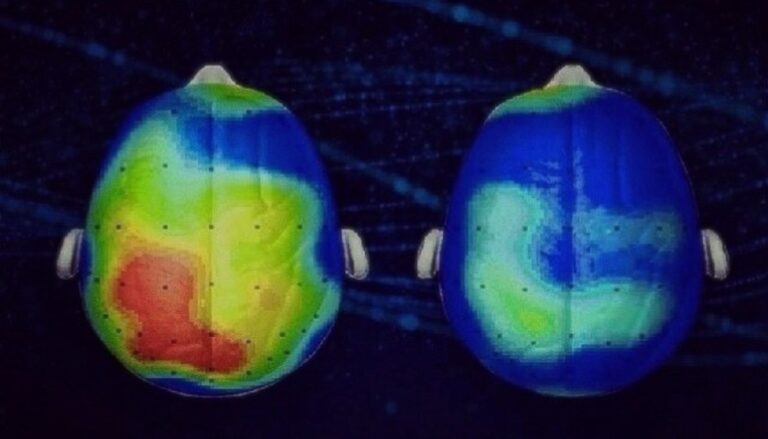 Νευροεπιστήμονες ανακάλυψαν ένα τραγούδι που μειώνει το άγχος κατά 65%  – Ακούστε το