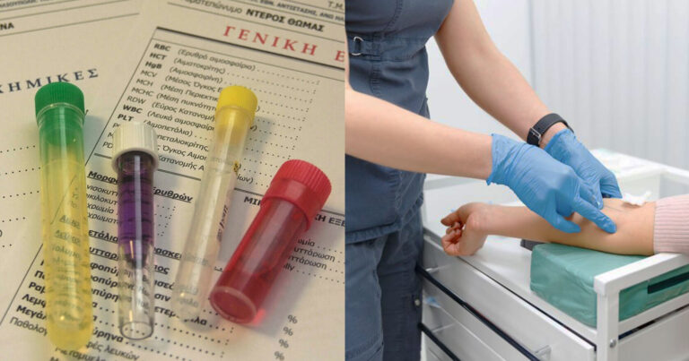 Εξετάσεις αiματος: Να τι σημαίνει κάθε εξέταση στη γενική αiματος και τι να κοιτάτε