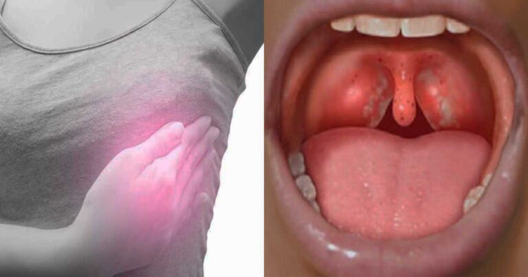 17 ύποπτα συμπτώματα καρκίνου που αρχικά μοιάζουν «αθώα» και πρέπει να σας κινητοποιήσουν