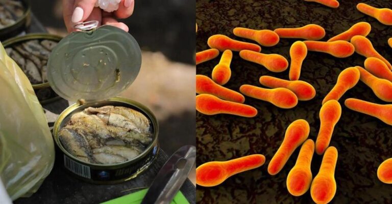 Αλλαντίαση: Τι είναι, ποια τρόφιμα μπορούν να την προκαλέσουν – Τα πρώτα συμπτώματα και οι τρόποι προστασίας