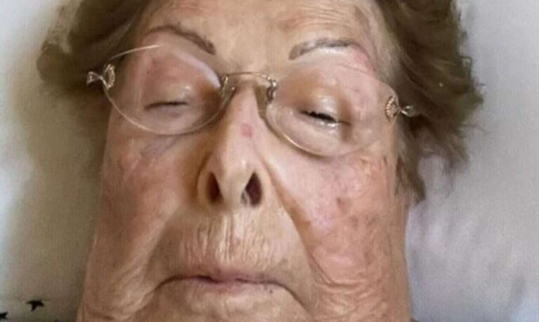 Βέφα Αλεξιάδου: Καταβεβλημένη στο κρεβάτι του νοσοκομείου – Η φωτογραφία στο Facebook