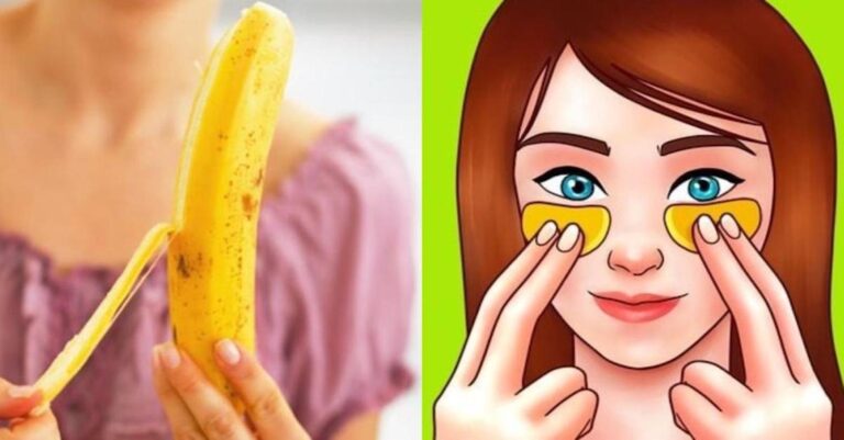 Φλούδα μπανάνας: Πριν την πετάξετε, δείτε τις απίθανες χρήσεις της για την υγεία και την ομορφιά