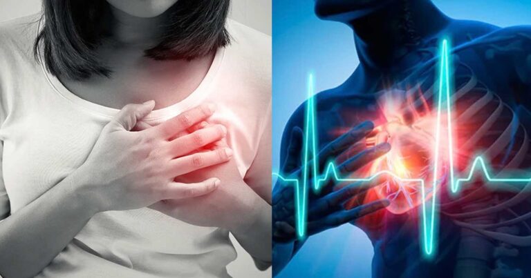 Η ανακοπή καρδιάς δεν εκδηλώνεται τόσο απότομα όσο νομίζουμε – Ποια είναι τα ύποπτα συμπτώματα