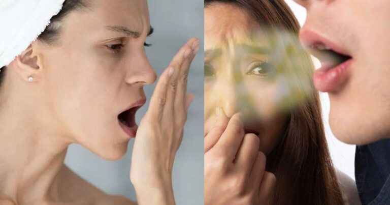 Κακοσμiα στόματος: Σύμπτωμα 7 διαφορετικών ασθενειών – Μήπως να το ψάξετε;