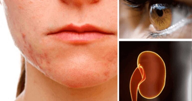 Ποια όργανα επηρεάζει το στρες περισσότερο και γιατί