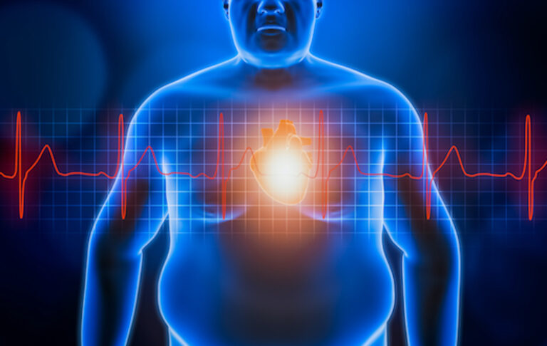 Σπλαχνικό λiπος: 5 σημαντικά βήματα για να φύγει, σύμφωνα με διαιτoλόγoυς