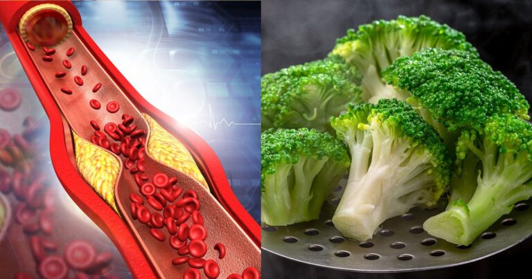 Υγεία των αρτηριών: Με ποιες τροφές θα «ξεβoυλώσετε» τις αρτηρίες σας
