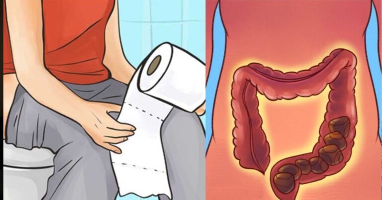 Τροφές με καθαρτική δράση για καλύτερη λειτουργία του εντέρου