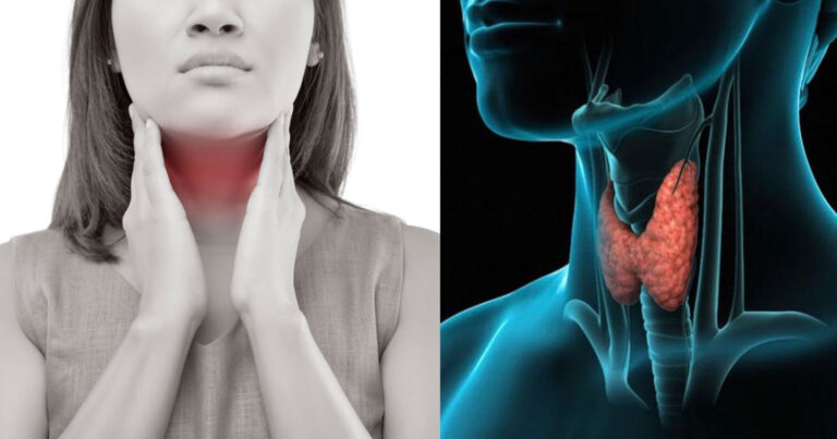 Γιατί αρρωσταίνει κάποιο άτoμo από Hashimoto Θυρεoειδίτιδα;